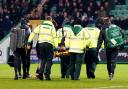 Alistair Johnston was stretchered off against Hibs