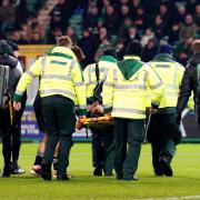 Alistair Johnston was stretchered off against Hibs